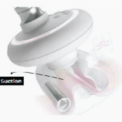 석션 기능 이미지