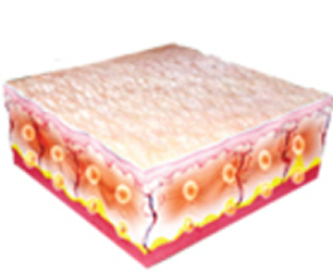 열응고점을 중심으로 피부의 안과 밖에서 리프팅이 일어남